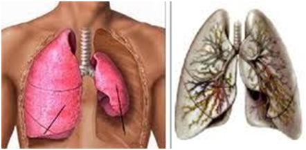 Triệu chứng mắc bệnh liên quan đến phổi